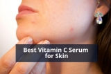 Best Vitamin C Serum for Acne
