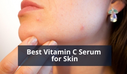 Best Vitamin C Serum for Acne